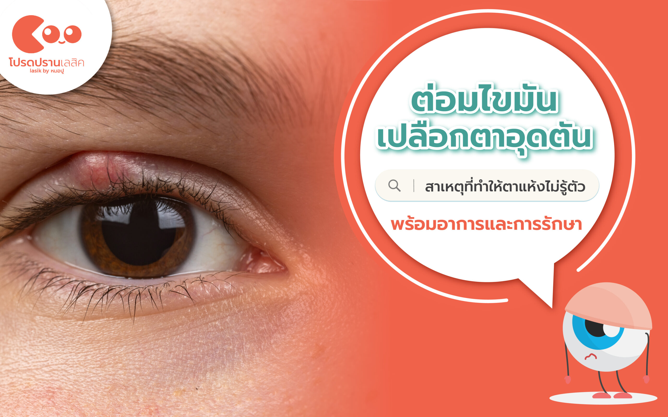 ต่อมไขมันเปลืองตา