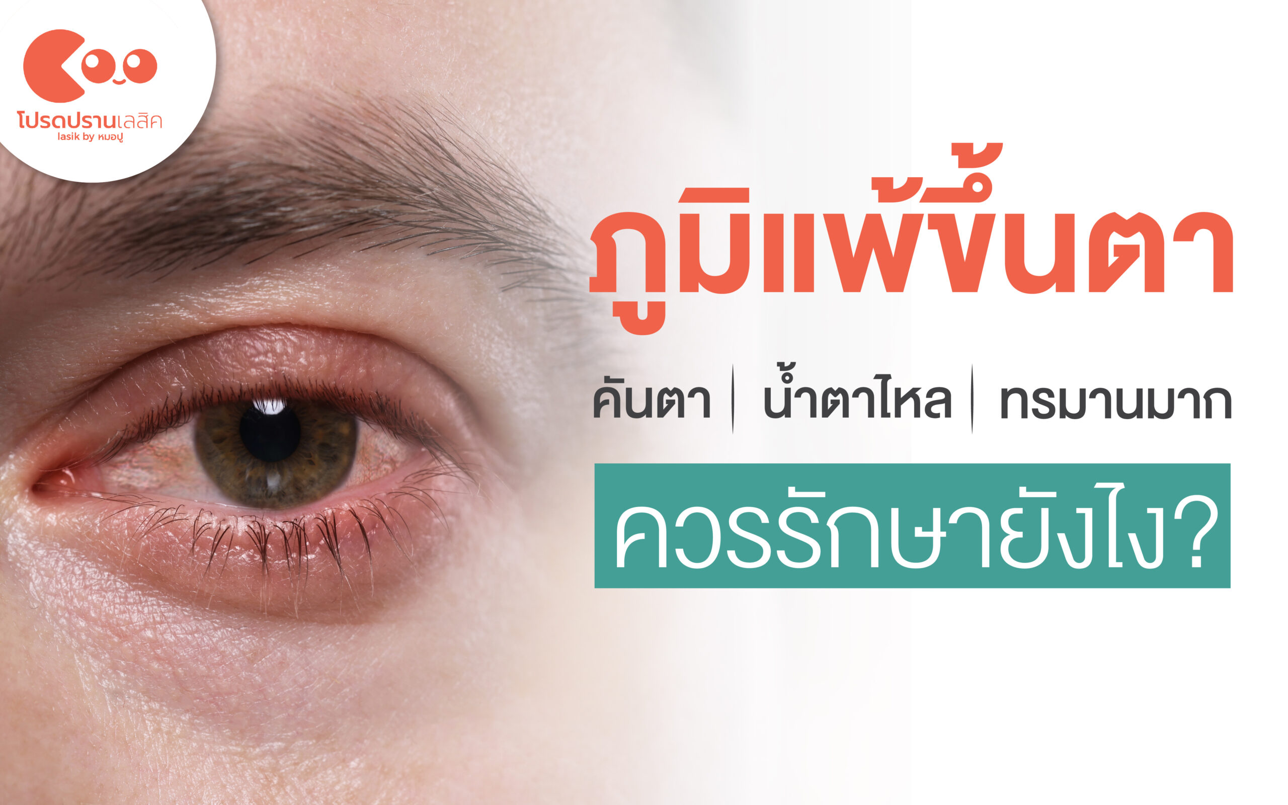 ภูมิแพ้ขึ้นตา คันตา น้ำตาไหล ทรมานมาก ควรรักษายังไง