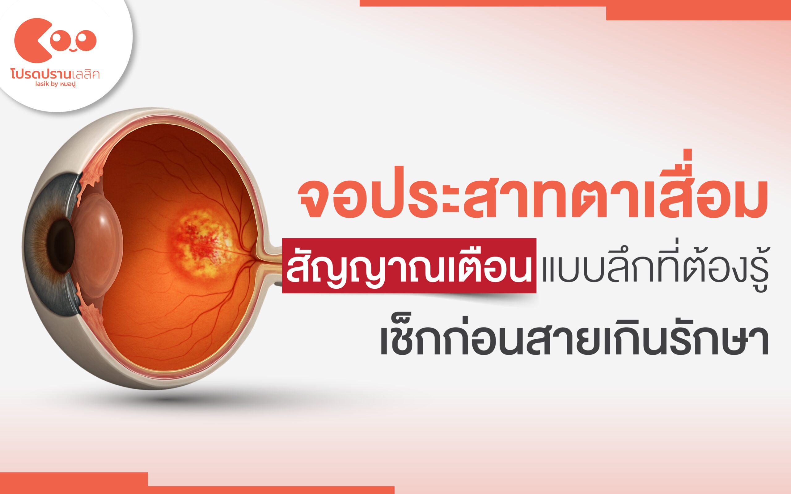 จอประสาทตาเสื่อม สัญญาณเตือนแบบลึกที่ต้องรู้ เช็กอาการเสี่ยงก่อนสายเกินรักษา