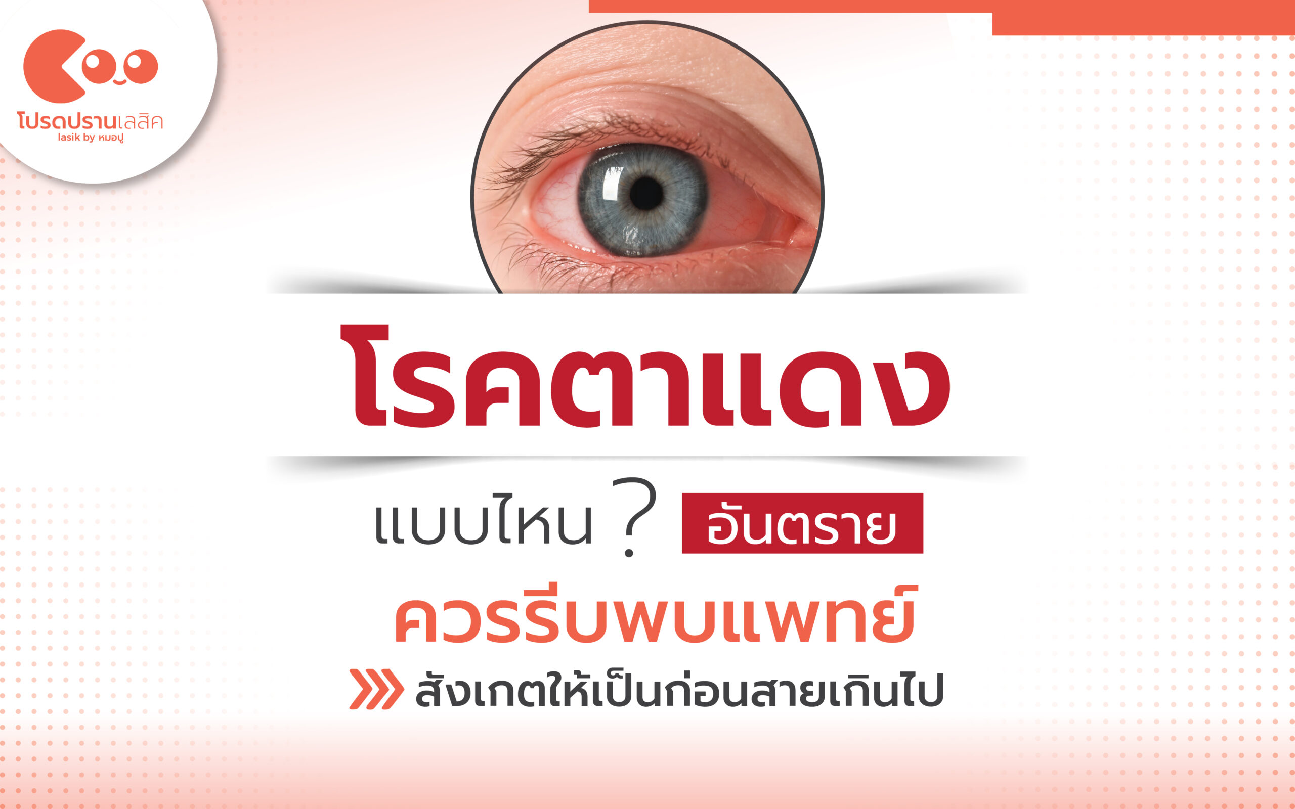 โรคตาแดง แบบไหนอันตรายควรรีบพบแพทย์ สังเกตให้เป็นก่อนสายเกินไป