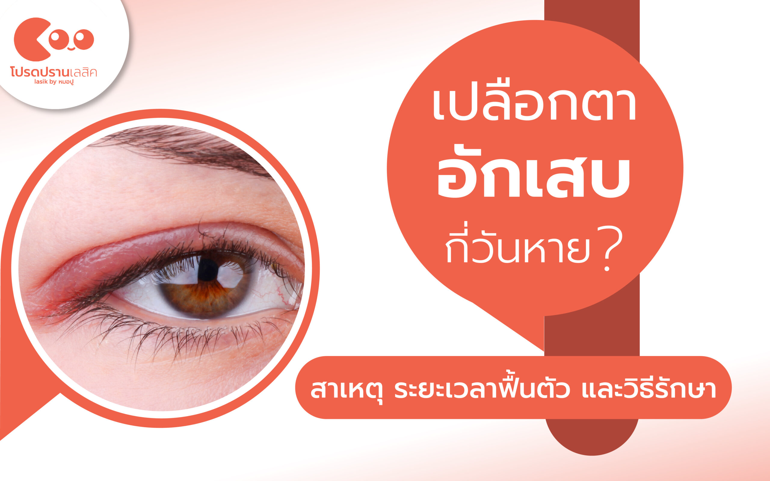 เปลือกตาอักเสบ กี่วันหาย? ระยะเวลาฟื้นตัว อาการที่ควรรู้ และแนวทางดูแลอย่างถูกต้อง