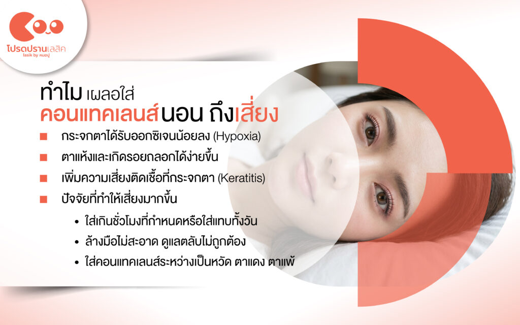 ผลของการใส่คอนแทคเลนส์นอนหลับ