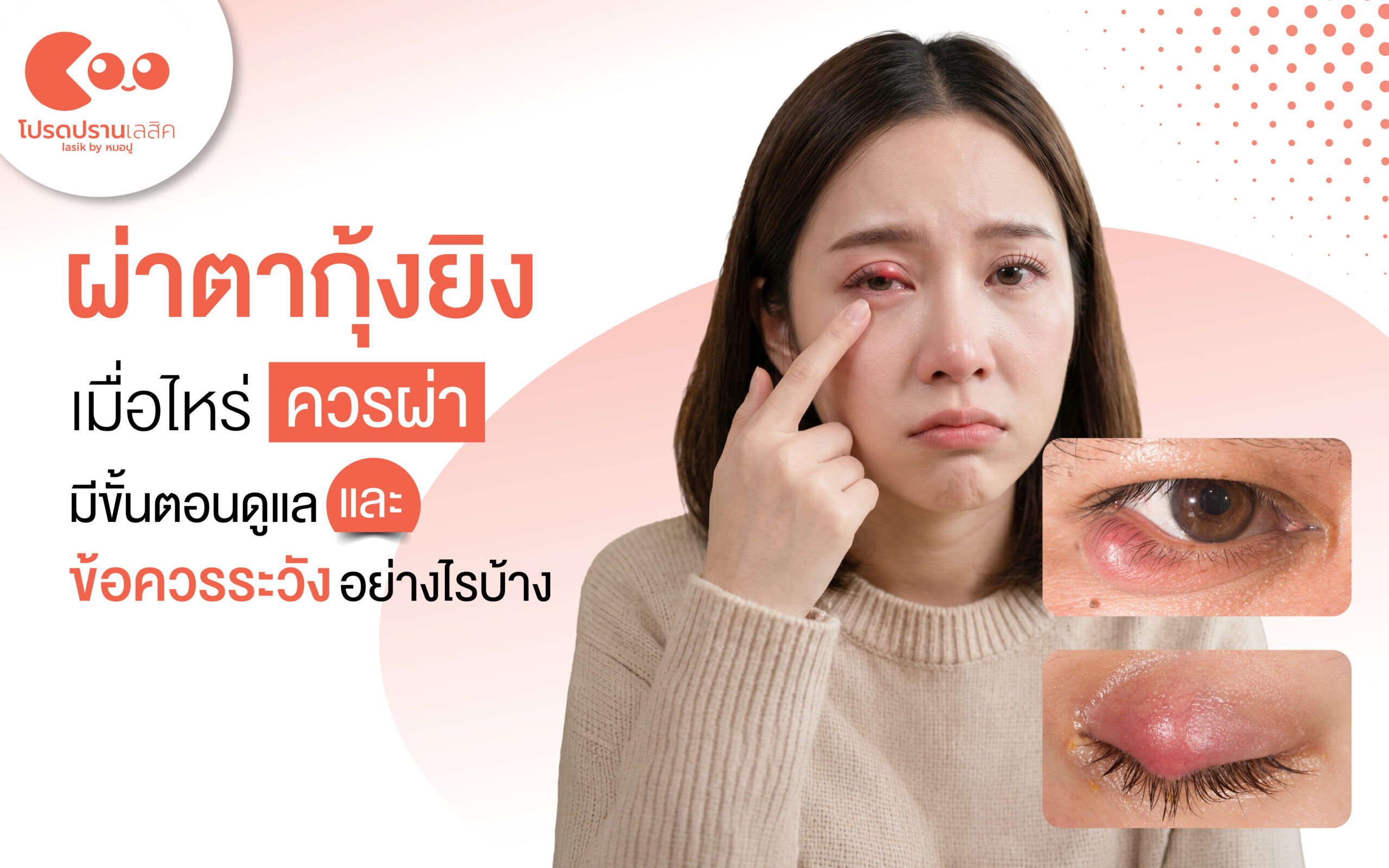 ผ่าตากุ้งยิง เมื่อไหร่ควรผ่า