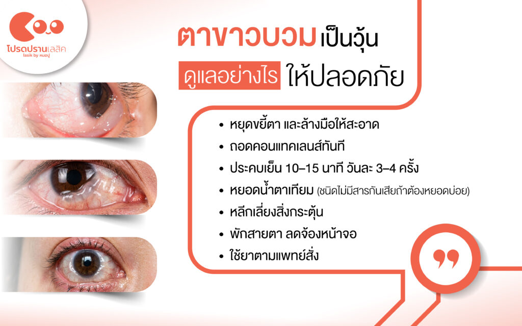 วิธีรักษาตาขาวบวมเป็นวุ้น