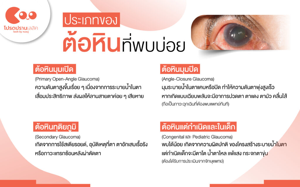 ต้อหิน อาการเตือน วิธีตรวจคัดกรอง